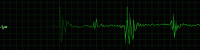 Flat-line 2